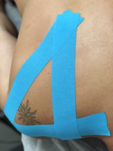 kinesiotape: Soporte y feedback