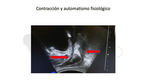 Suelo pélvico del hombre